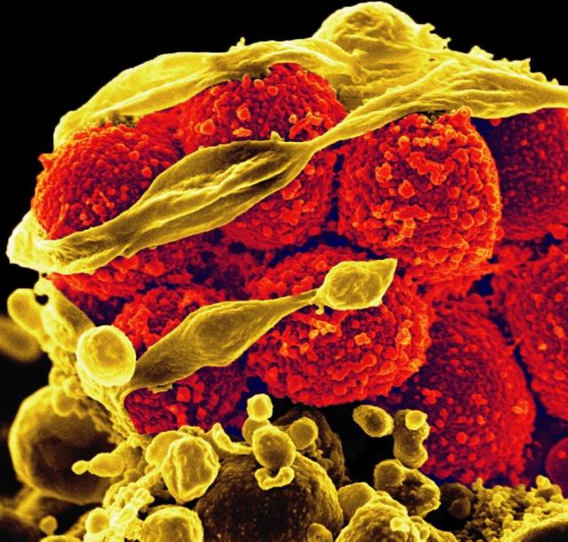 Antibiotic Resistance in Staphylococcus aureus