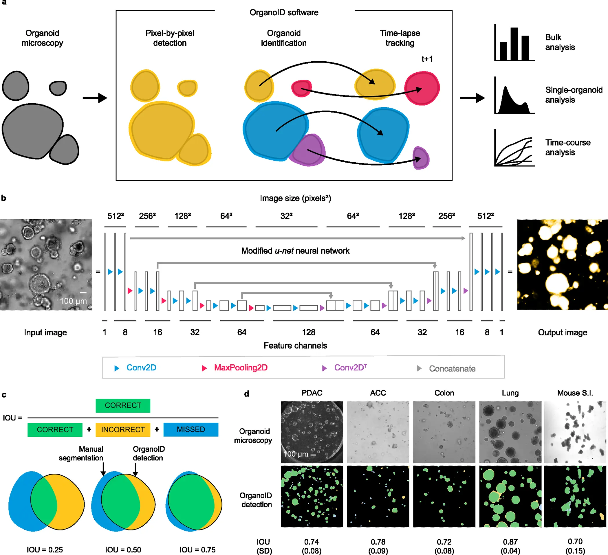 A deep learning platform OrganoID: analyzes and interprets the organoid models