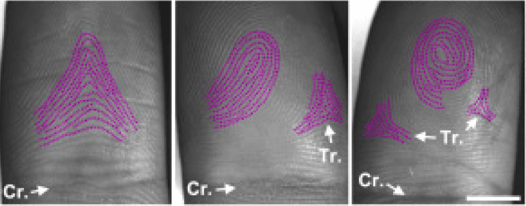 Mystery of Unique Fingerprint Pattern Formation