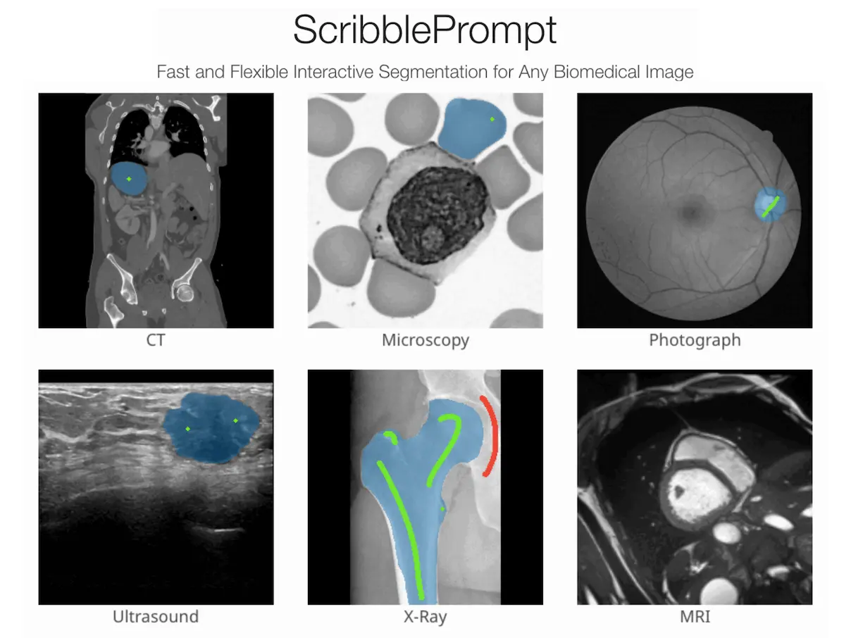 Speed and Precision in Medical Imaging: The Promise of ScribblePrompt
