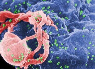 Cells Hosting HIV Tracked Using a Mathematical Model Scanning electron micrograph of HIV-1