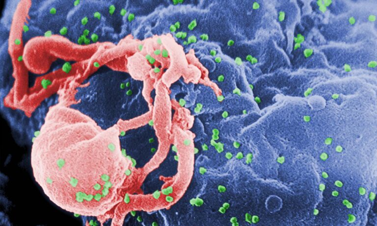 Scanning electron micrograph of HIV-1