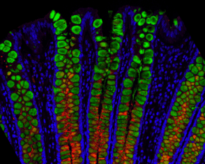 Entire Human Gut Mapped by Scientists at the Single-Cell Resolution goblet-cells_cropped-294x300