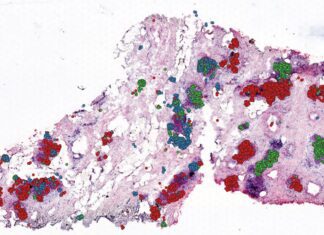 Scientists Developed a Computational Tool ‘CellTrek’ for Spatial Mapping of Single-Cell Data Within Tissues CellTreck