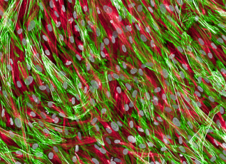 Single-Cell Map of Heart Failure Provides Insights into Novel Potential Therapeutic Targets and Biomarkers Heart Failure