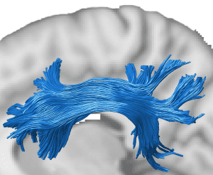 human brain connections, machine learning