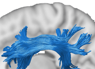 Scientists Develop a Novel GPU-based Machine Learning Model to Discover Human Brain Connectivity human brain connections, machine learning