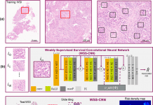 Disease Prognosis Using Deep Learning and H&E Images – Emerging Tool for Clinical Trial Optimization Disease Prognosis Using Deep Learning And Images