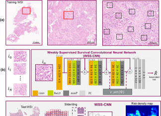 Disease Prognosis Using Deep Learning and H&E Images – Emerging Tool for Clinical Trial Optimization Disease Prognosis Using Deep Learning And Images