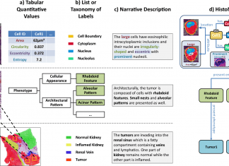 ‘HistoML’ – A Markup Language based on Semantic Web Technologies for Representation and Exchange of Histopathological Information in Pathology Images Histopathology Markup Language, Cancer