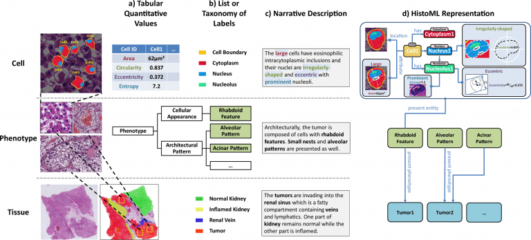 Histopathology Markup Language, Cancer