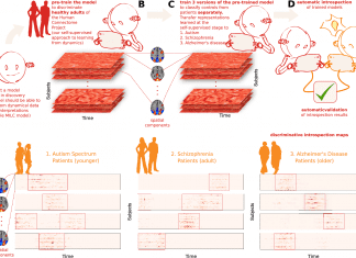 Advanced AI in Brain Imaging Captures Dynamic Mental Illness Markers