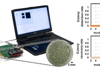 AI-Powered Innovative Bacterial Colony Detection System Using a Thin-Film Transistor (TFT) Array – A Technology Often Seen in Mobile Phone Displays bacterial, thin film transistor, pathogenic bacteria