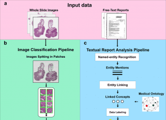 Scientists Develop Digital Pathology Models without Human Intervention by Integrating Clinical Healthcare Data with AI digital pathology limits the human effort to a minimum