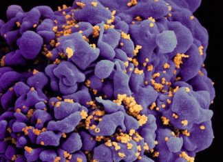 Scientists Propose a Computational Approach for Predicting HIV Combination Therapies to Prevent Viral Escape and Rebound Scientists Propose a Computational Approach for Predicting HIV Combination Therapy to Prevent Viral Escape and Rebound