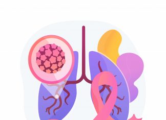 Clinical Validation of Deep Learning Algorithm to Simplify Lung Cancer Radiotherapy Treatment Deep Learning Algorithm to Simplify Lung Cancer Radiotherapy Treatment
