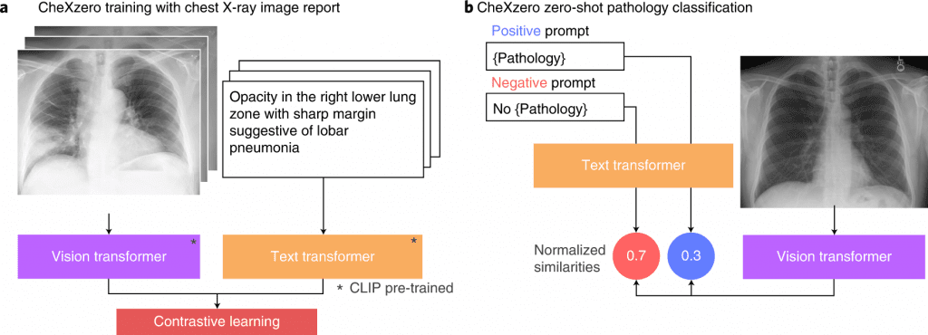 CheXzero can Identify Pathologies from Unannotated Chest X ray Images Using Self-supervised Learning