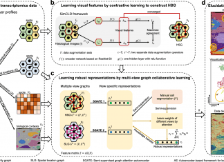 Attention-based Multi-view Graph Collaborative Learning Model ‘stMVC’ to Decipher Tumor Heterogeneity in Spatial Transcriptomics Data stMVC model for analyzing tumor heterogeneity in spatial transcriptomics data.
