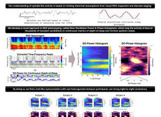 Novel EEG Phenotyping to Identify Neurological Disease from Sleep Brainwaves TF-peaks