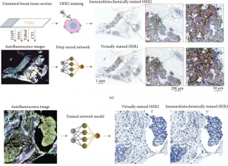 Researchers Introduced a Deep Learning-based Label-Free Virtual HER2 Immunohistochemical Staining of Breast Tissue Virtual HER2 staining of unlabeled tissue sections via deep learning.