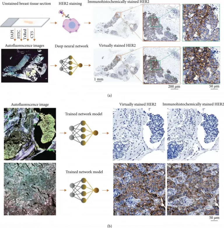 Virtual HER2 staining of unlabeled tissue sections via deep learning.