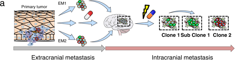 Molecular Subsets Involved in Brain Metastases of Melanoma