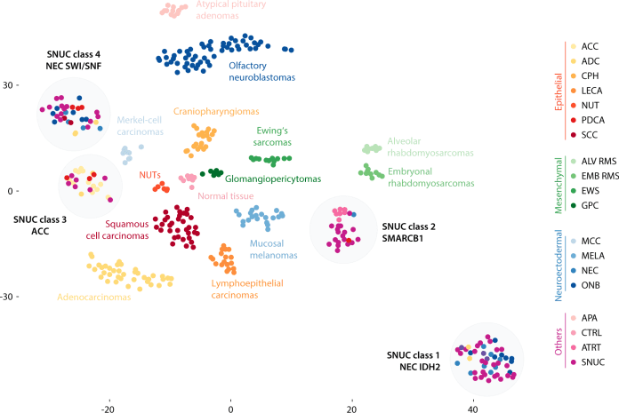 DNA methylation classes of sinonasal tumors