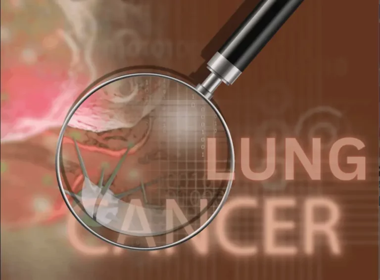 Combination Therapy: Engineered Bacterial Therapeutics and Traditional Cancer Treatments for Improved Lung Cancer Outcomes