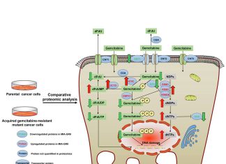 Pancreatic Cancer and Drug Resistance: Researchers Identify Key Metabolic Regulators Pancreatic Cancer and Drug Resistance: Key Regulators Driving Gemcitabine Resistance In Pancreatic Adenocarcinoma