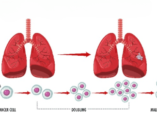 Uncovering Lung Cancer’s Immune Evasion Tactics: Groundbreaking Study Sheds Light on a Key Mechanism Lung Cancer's Immune Evasion Tactics