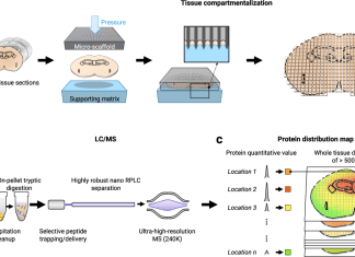 In-depth Mapping of Protein Localizations in Whole Tissue Using Micro-scaffold Assisted Spatial Proteomics (MASP) In-depth Mapping of Protein Localizations in Whole Tissue using Micro-scaffold Assisted Spatial Proteomics (MASP)