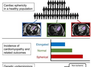 Why the Shape of Your Heart Could be the Key to a Longer and Healthier Life Developing atrial fibrillation and heart muscle disease can be predicted by the heart shape as well as certain genetic indicators.