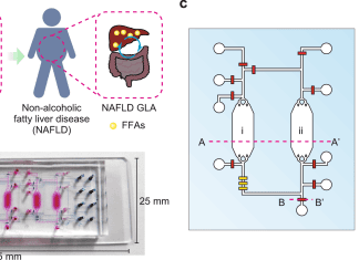 Scientists Introduce Integrated-gut-liver-on-a-chip ‘iGLC’ Platform: an Innovative Human Model for Non-Alcoholic Fatty Liver Disease Integrated Gut-Liver-on-a-chip 'iGLC' Platform: an Innovative Human Model for Non-Alcoholic Fatty Liver Disease