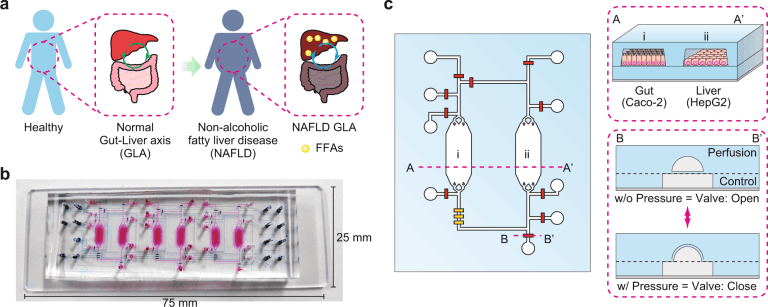 Integrated Gut-Liver-on-a-chip 'iGLC' Platform: an Innovative Human Model for Non-Alcoholic Fatty Liver Disease