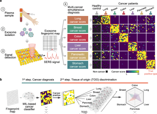Researchers Offer an Innovative Single Test-Based Approach for Early Stage Cancer Diagnosis using Exosomes, SERS Technology, and AI Researchers Offer an Innovative Single Test-Based Approach for Early Stage Cancer Diagnosis using Exosomes, SERS Technology and AI
