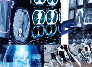 Exploring the Potential of DALL-E 2 for AI-driven Image Generation in Radiology Exploring the Potential of DALL-E 2 for AI-Driven Image Generation in Radiology