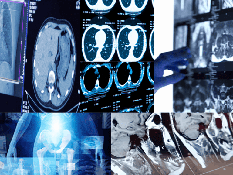 Exploring the Potential of DALL-E 2 for AI-Driven Image Generation in Radiology