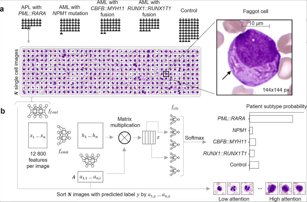 Explainable AI Detects Diagnostic Cells of Genetic AML Subtypes