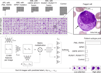 The Future of Cancer Care: Explainable AI Detects Diagnostic Cells of Genetic AML Subtypes Explainable AI Detects Diagnostic Cells of Genetic AML Subtypes