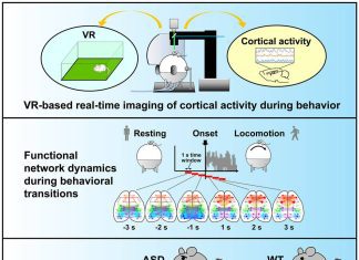 Using Virtual Reality-based Real-time Imaging to Unravel the Complexities of Autism’s Neural Network Dynamics Using Virtual Reality-based Real-Time Imaging to Understand Brain Activity and Behaviour in Neuropsychiatric Disorders