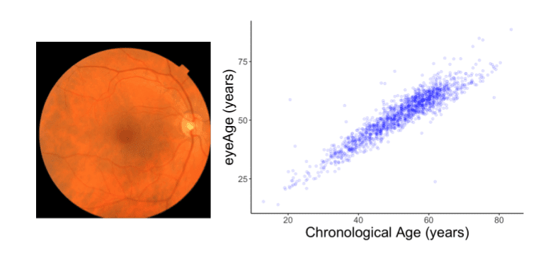 Deep Learning on Retinal Images: Google's Aging Clock 'eyeAge' Unlocks the Secrets of Aging