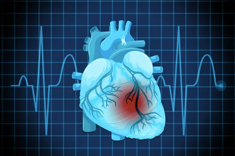 Broad's Scientists Introduce a Machine Learning Model to Identify Genetic Factors for Cardiovascular Diseases