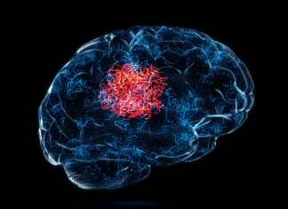 Fast-tracking CNS Tumor Diagnosis: New AI System ‘Sturgeon’ Accurately Diagnoses Brain Tumors in Minutes Fast-tracking CNS Tumor Diagnosis: New AI System 'Sturgeon' Accurately Diagnoses Brain Tumors in Minutes