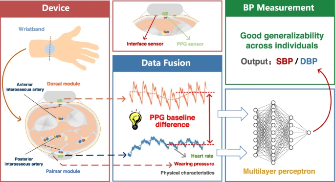 Advancing Continuous Blood Pressure Monitoring: Accurate Measurements with Multichannel Sensing Signals in Wearable Devices