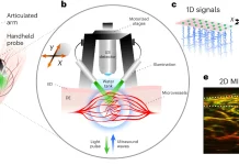 A New Era in Diabetes Assessment: Skin Scanner and AI Score Disease Severity Skin Scanner and AI Redefine Disease Severity Evaluation in Diabetics