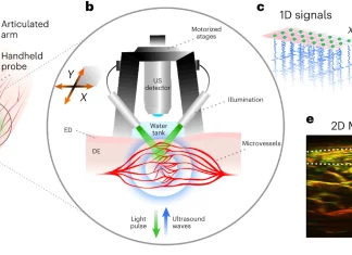 A New Era in Diabetes Assessment: Skin Scanner and AI Score Disease Severity Skin Scanner and AI Redefine Disease Severity Evaluation in Diabetics