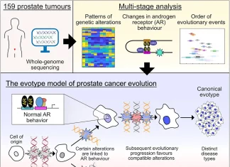 Prostate Cancer: Beyond One Disease? AI Uncovers Hidden Diversity Prostate Cancer: Beyond One Disease? AI Uncovers Hidden Diversity