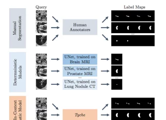 Empowering Clinicians: How ‘Tyche’ Revolutionizes Medical Image Analysis with AI to Address Uncertainties Empowering Clinicians: How 'Tyche' Revolutionizes Medical Image Analysis with AI to Address Uncertainties