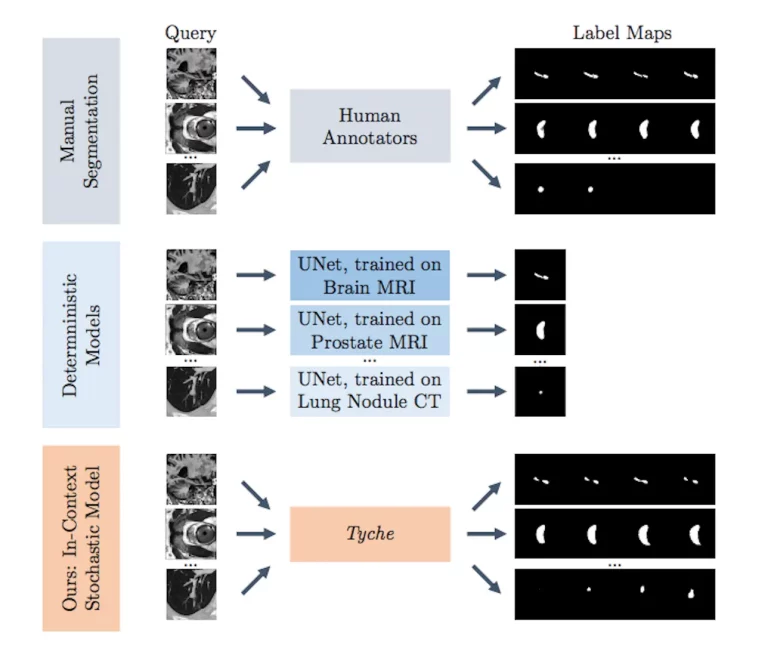 Empowering Clinicians: How 'Tyche' Revolutionizes Medical Image Analysis with AI to Address Uncertainties