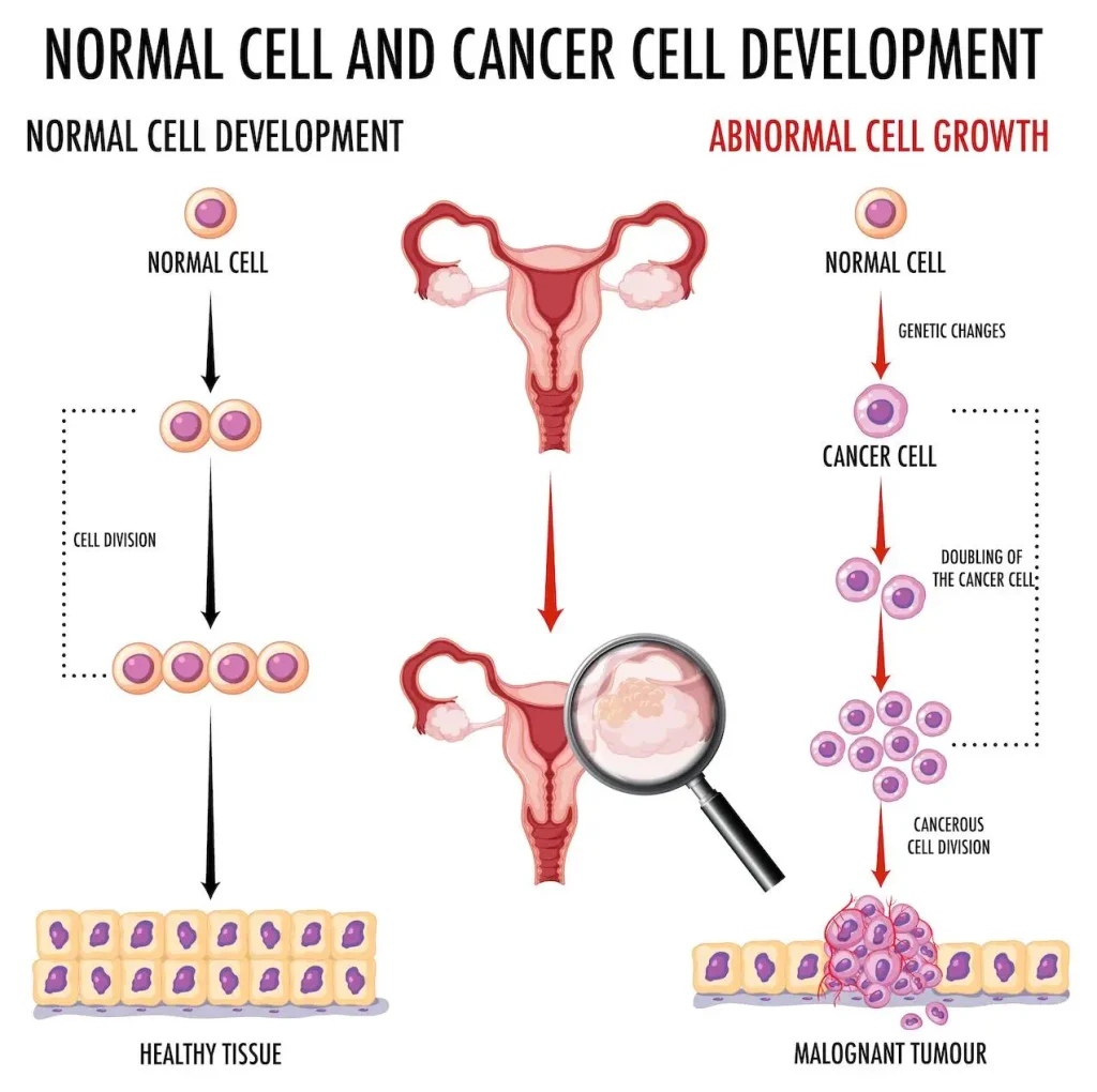 Image Description: Tumor growth progression in ovarian cancer.